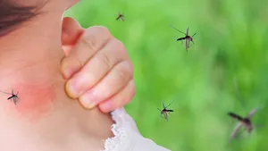 Sivrisinek ısırıklarına son! İşte evinizde uygulayabileceğiniz 8 doğal korunma yöntemi