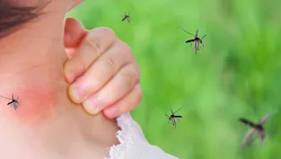 Sivrisinek ısırıklarına son! İşte evinizde uygulayabileceğiniz 8 doğal korunma yöntemi
